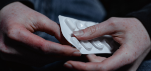 Birth Control: One of the Major Melasma Causes