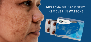 Pynocare: Melasma or Dark Spot Remover in Watsons