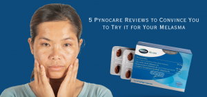 5 Pynocare Reviews to Convince You to Try it for Your Melasma