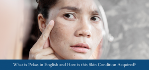 What is Pekas in English and How is this Skin Condition Acquired?