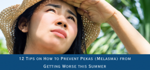 12 Tips on How to Prevent Pekas (Melasma) from Getting Worse this Summer