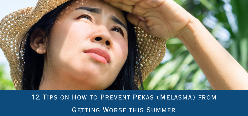 tips to prevent melasma in summer