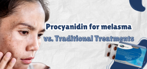 Procyanidin for Melasma vs Traditional Treatments