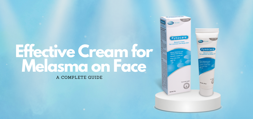 melasma cream on face