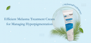 Efficient Melasma Treatment Cream for Managing Hyperpigmentation