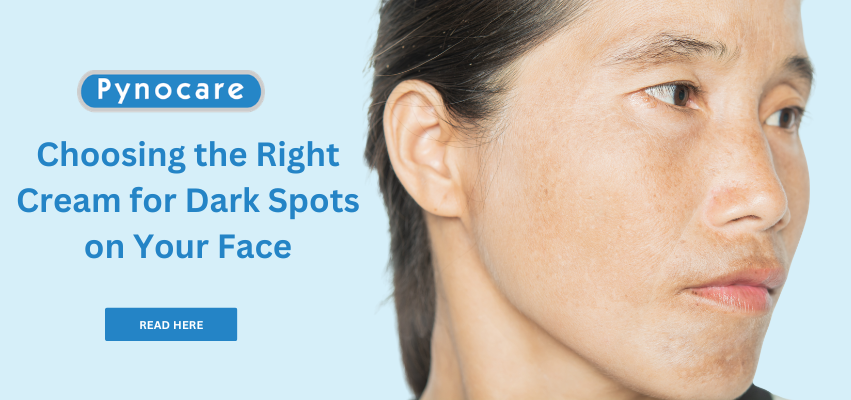 cream for dark spots considerations