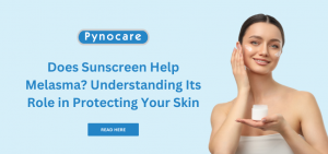 Does Sunscreen Help Melasma? Understanding Its Role in Protecting Your Skin