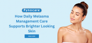 How Daily Melasma Management Care Supports Brighter Looking Skin