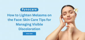 How to Lighten Melasma on the Face: Skin Care Tips for Managing Visible Discoloration