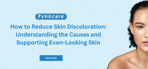 How to Reduce Skin Discoloration: Understanding the Causes and Supporting Even-Looking Skin