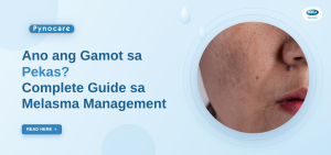 Anong Gamot sa Pekas? Complete Guide sa Melasma Management