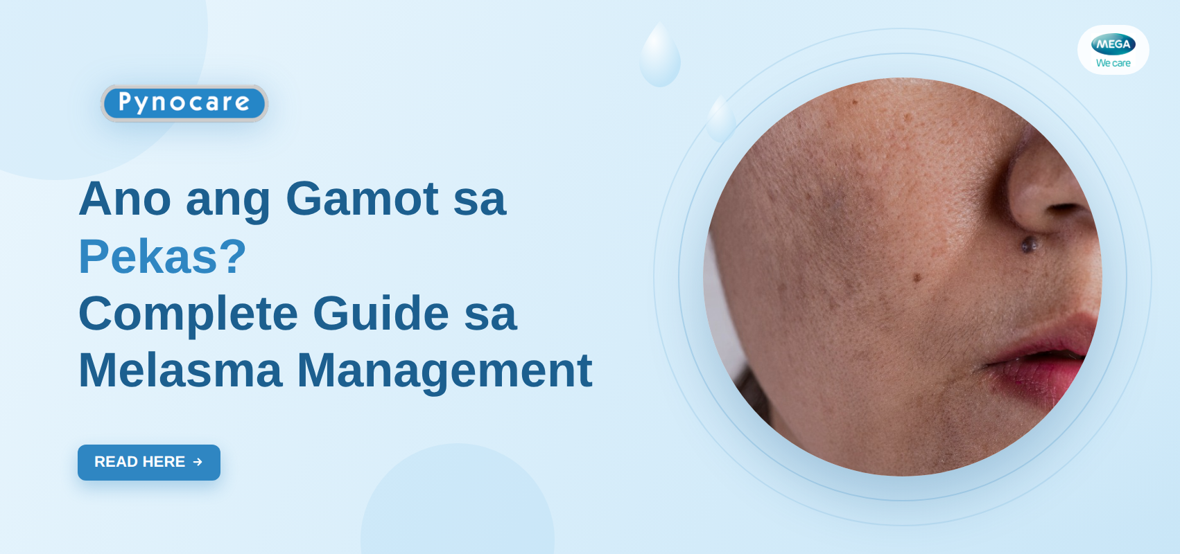Ano ang gamot sa pekas melasma guide