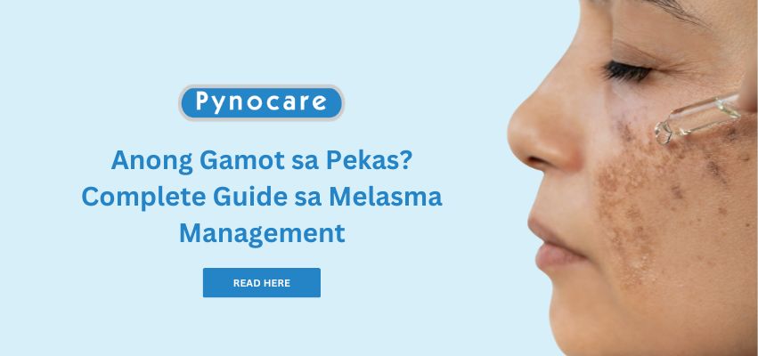 gamot sa melasma